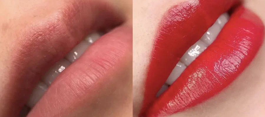 Can Lip Tattooing Fix Uneven Lips?