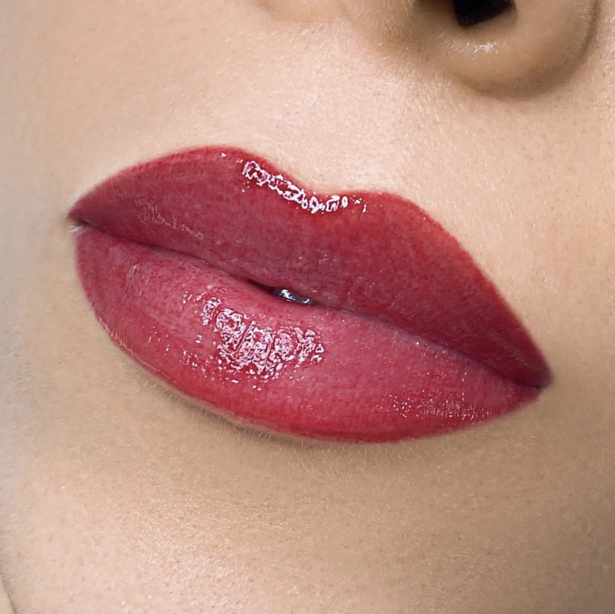 Dark lip neutralisation