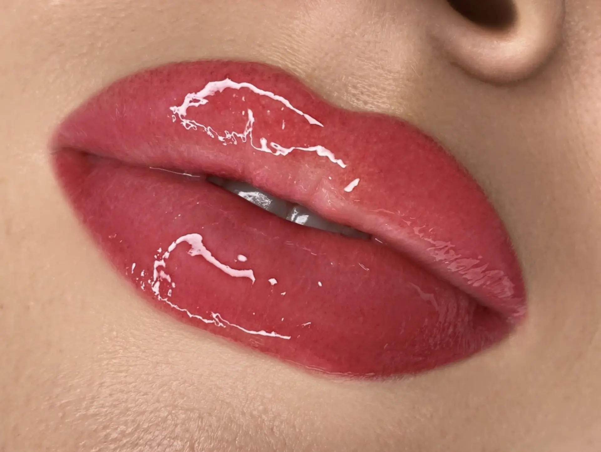Lip blush for asymmetry