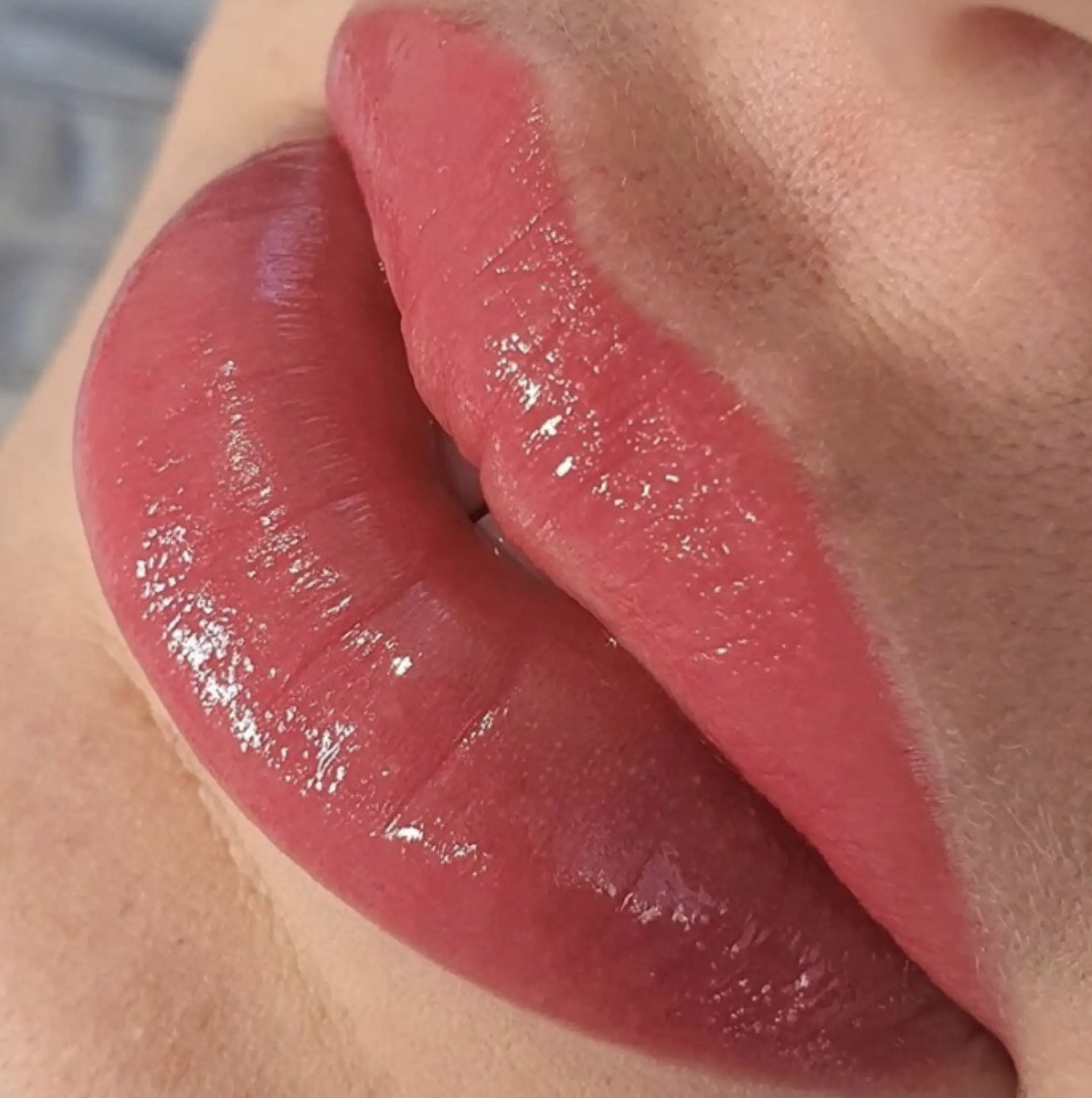 Lip tattoo correction Brisbane
