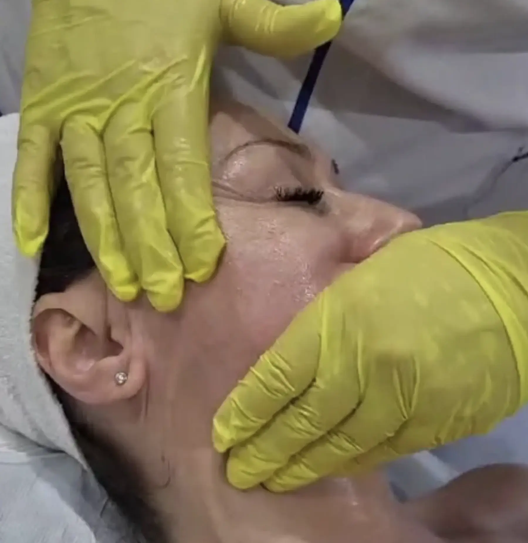 Is buccal massage legit or just a trend?